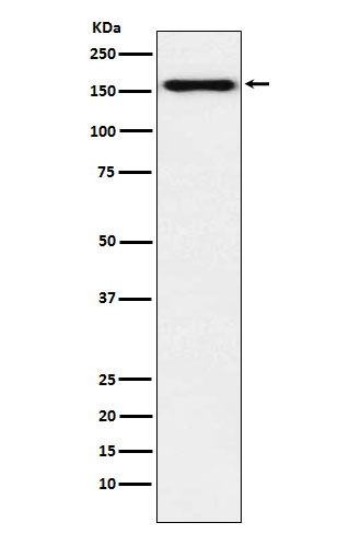 WB - Desmoglein 2 Antibody AP91954